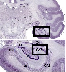 These signs are mainly visible in the temporal lobes and hippocampus,[1] with following images taken from its CA3 area, marked in box.