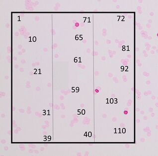 The third area yields 110 cells. The average number of cells per area is now calculated as the mean of 100, 94, 108 and 110, which is 103.