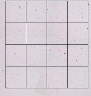 With an average of 103 cells per area, the number of areas needed to presumably include at least 2000 cells in our case is another 16.