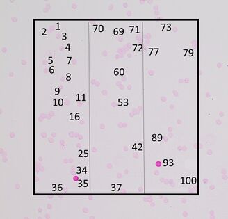 100 cells are counted, and their area is marked with a rectangle.