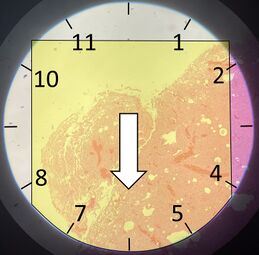 Starting at top left in the view, aim to scan a strip that trajects a circular field of view approximately at the clock positions shown...