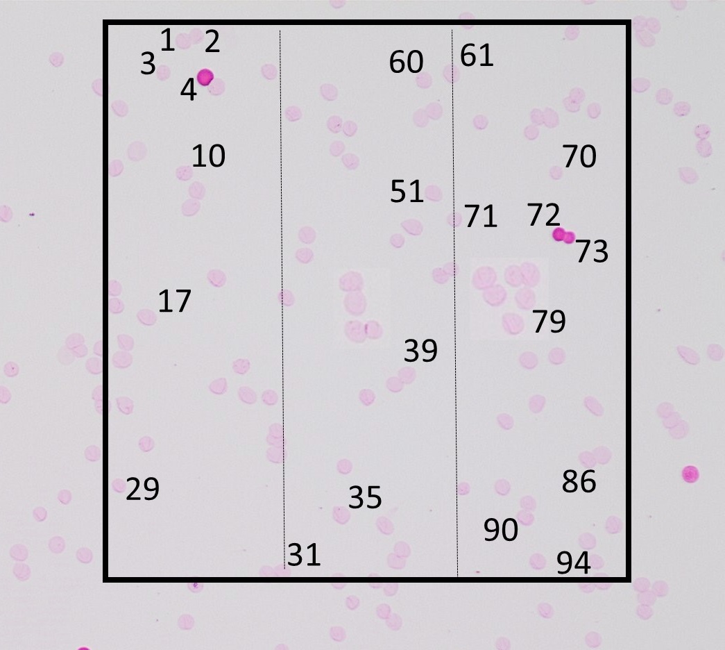 A new location is randomly chosen, and inside the same rectangular area, 94 cells are counted. This is a deviation 6 cells compared to the first count.