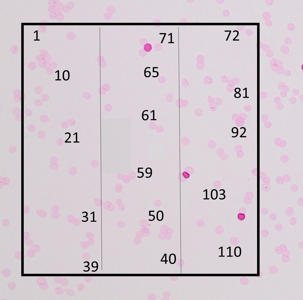 The third area yields 110 cells. The average number of cells per area is now calculated as the mean of 100, 94, 108 and 110, which is 103.
