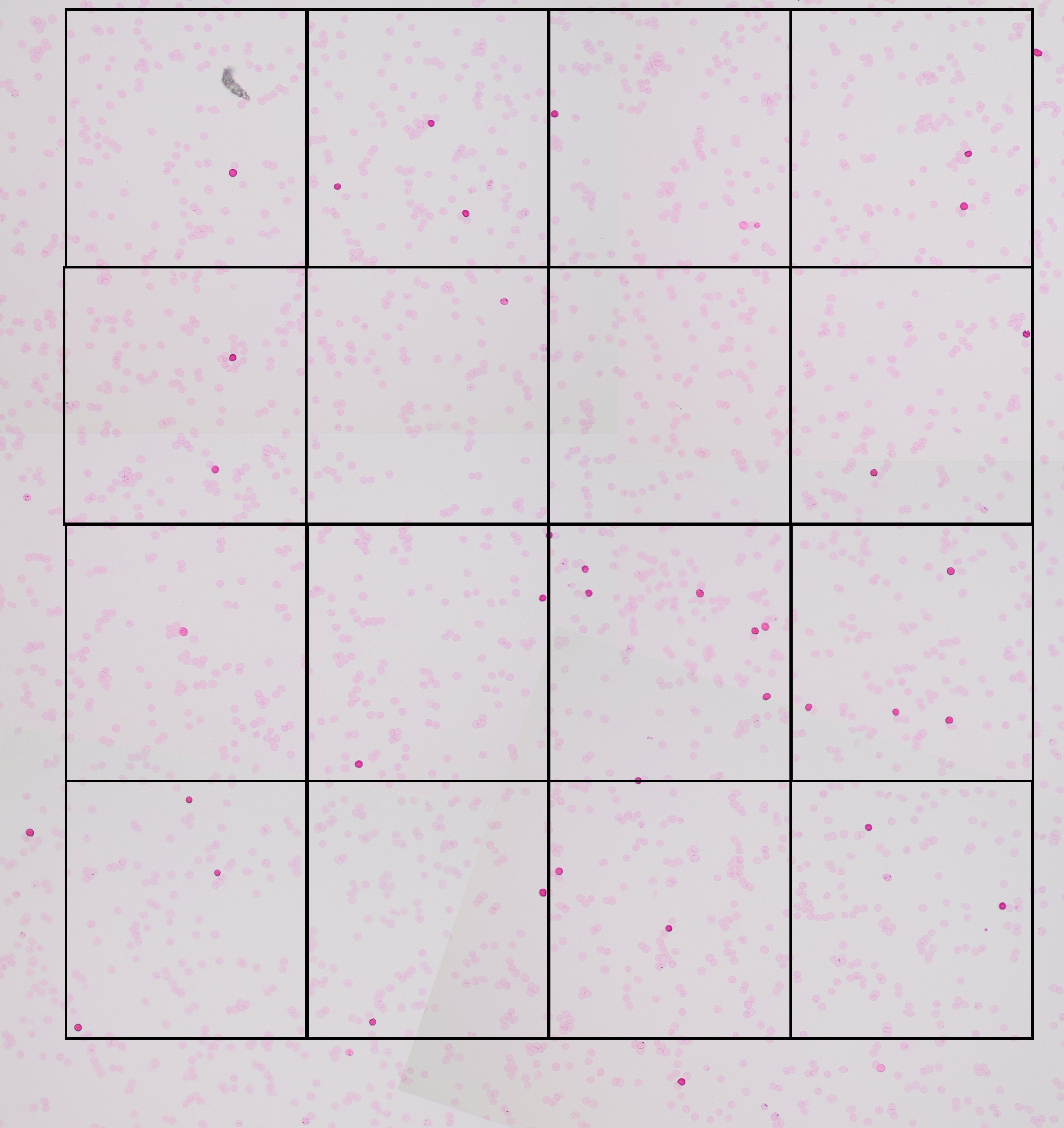 With an average of 103 cells per area, the number of areas needed to presumably include at least 2000 cells in our case is another 16.